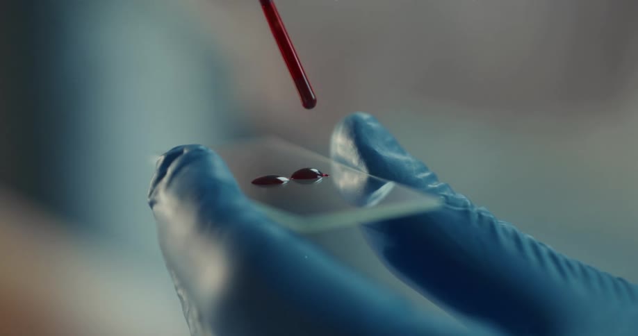 A person holds a glass microscope slide and applies blood drops to it