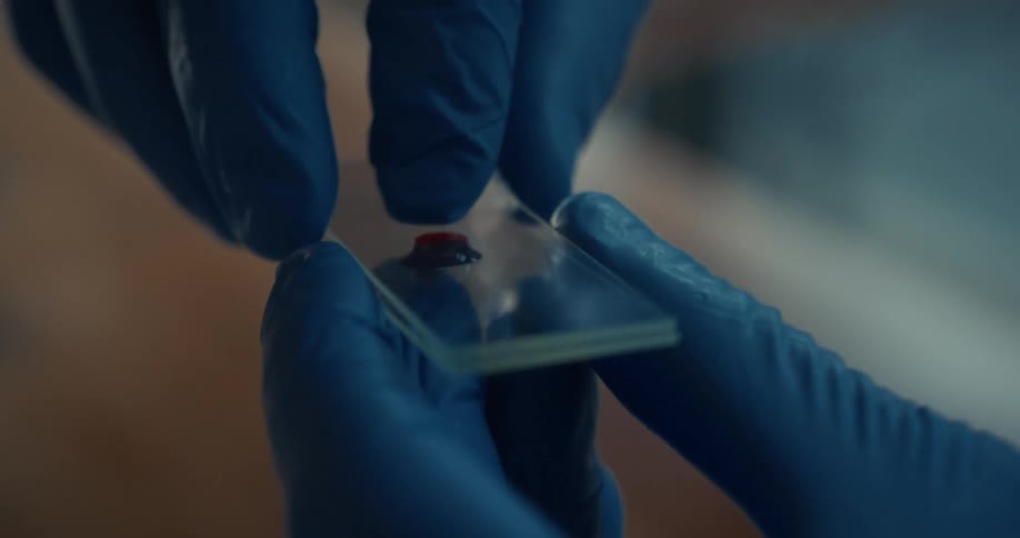 Hands wearing blue gloves hold a glass slide with an insect on its surface