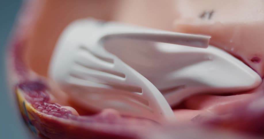 The person opens the medical device