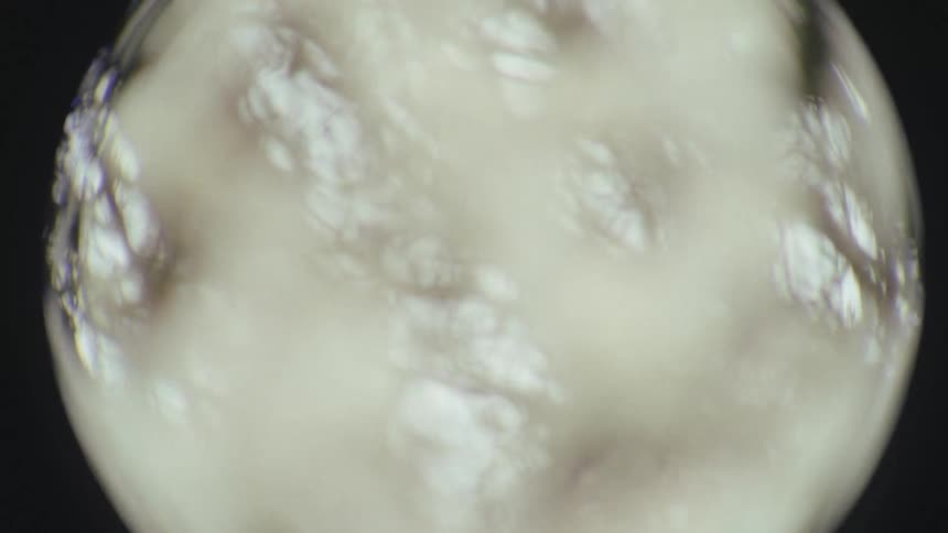 A dreamy, soft-focus macro shot of delicate white spring blossoms on a tree branch seen through a circular lens