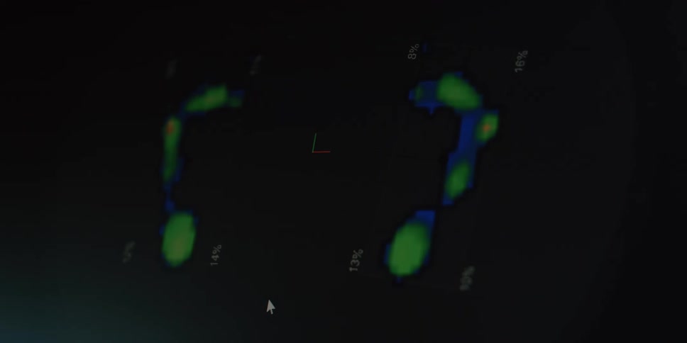 A close-up of a digital gait analysis on a computer screen displaying a heat map of footprints