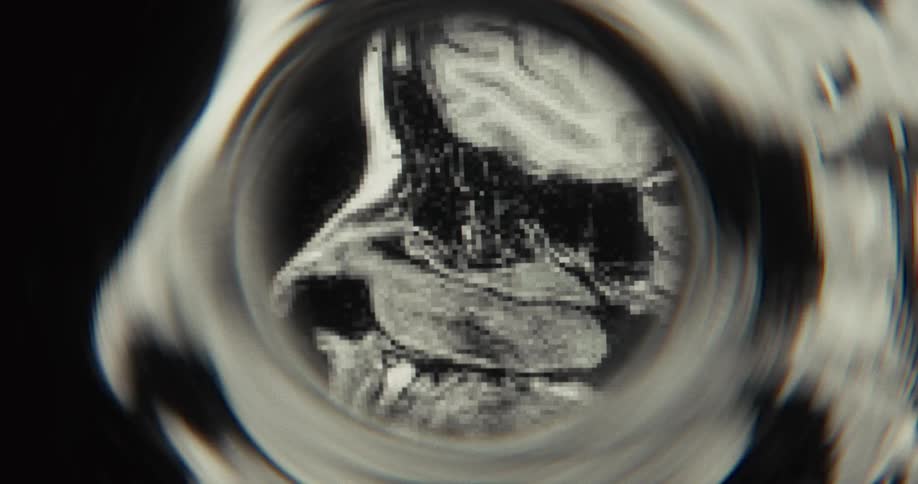 An abstract, warped close-up of a black and white human head MRI scan in motion