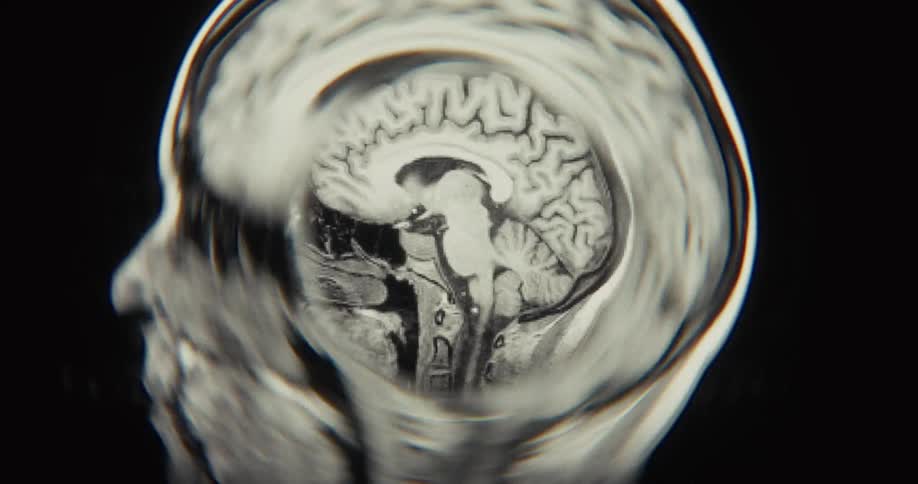 An abstract, black and white MRI scan reveals the cross-section of a human brain in a close-up, animated sequence