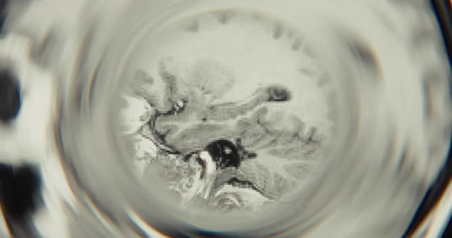 An abstract, animated view of a black and white MRI brain scan with a distorted, swirling lens effect
