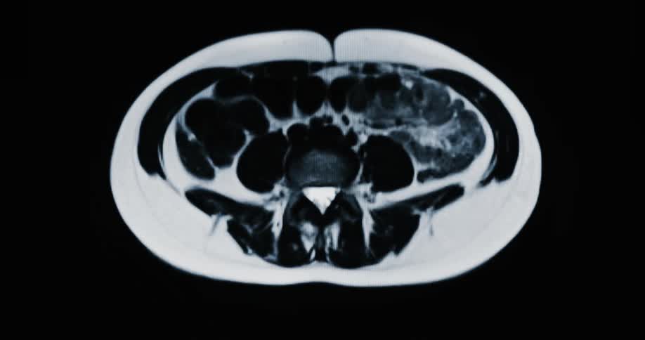 An animated medical MRI scan reveals a cross-section of a human torso, moving from the pelvis to the chest