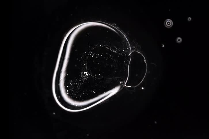 A glowing, cell-like bubble merges with another and slowly dissolves in this abstract microscopic view against a black background