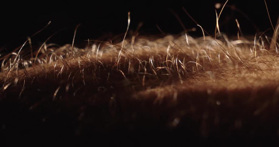 Dramatic macro shot of arm hair standing on end, a phenomenon known as goosebumps or piloerection