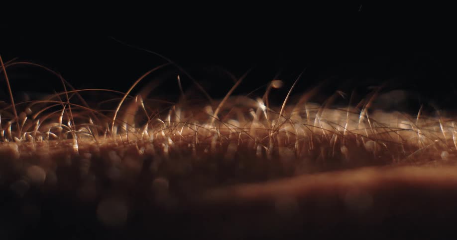An extreme macro close-up shot of human hairs standing on end, covered in tiny water droplets