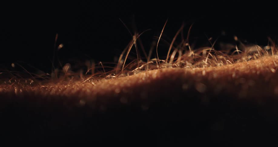 A dramatic macro shot shows hair standing on end as goosebumps form on human skin against a black background