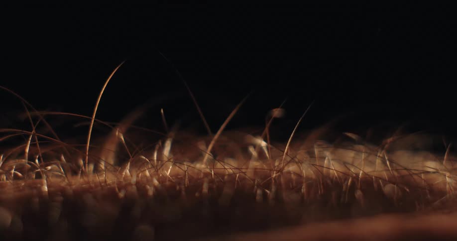 A macro close-up of human hair standing on end as goosebumps form on the skin against a dark background