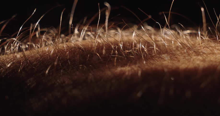 An intense macro shot shows the hair on a person's arm standing on end in a physiological response