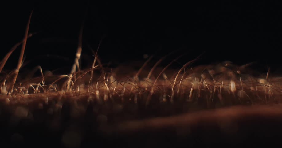 A dramatic macro shot shows hair on human skin standing on end during a goosebump reaction