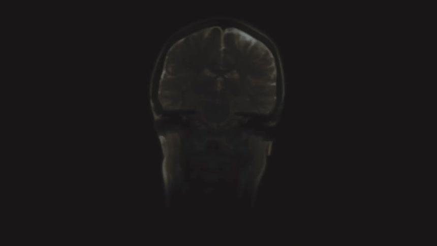 A compilation of animated MRI scans showing sagittal, axial, and coronal cross-sections of a human brain