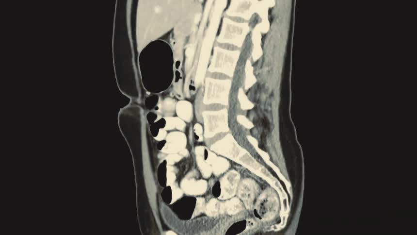An animated CT scan provides a comprehensive view of the human abdomen and pelvis in sagittal and coronal planes