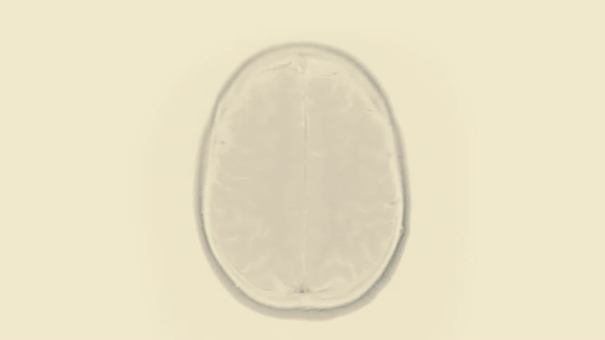 An abstract and fast-paced animation shows various glitching MRI brain scans on a black and white background