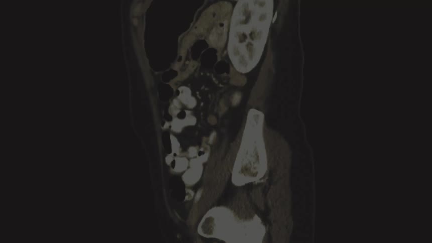 A medical imaging montage showing a sagittal CT scan of the abdomen and various MRI cross-sections of a human brain