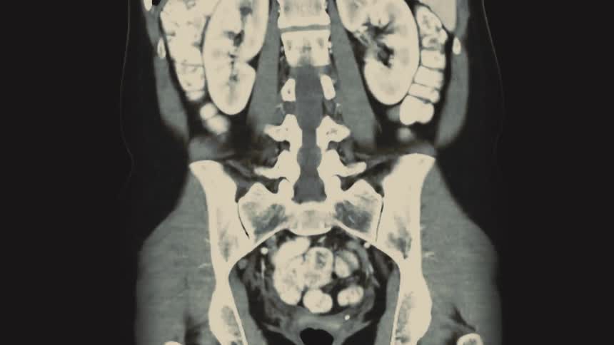 A detailed compilation of CT and MRI scans revealing the intricate internal structures of the human abdomen and brain