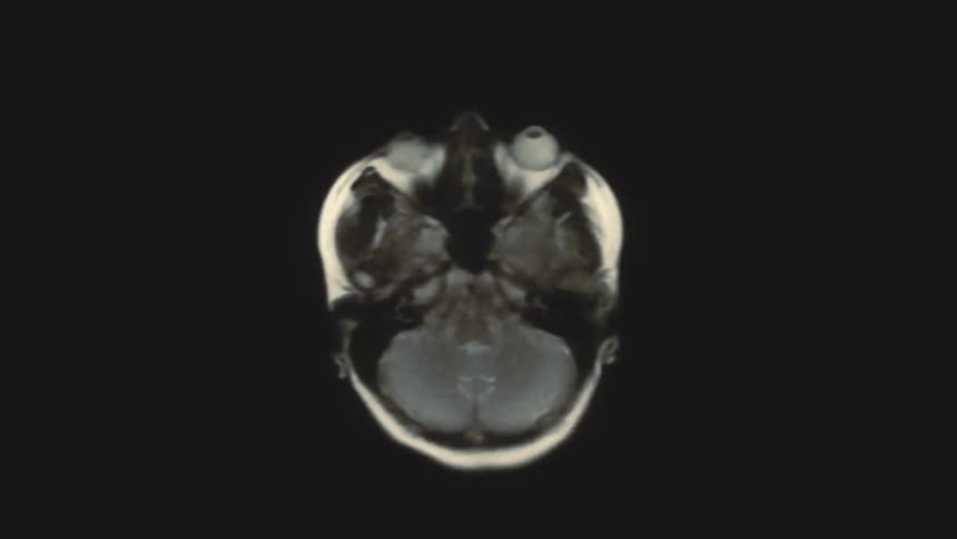 An intricate animation of MRI brain scans reveals the complex structures of the human head from multiple angles
