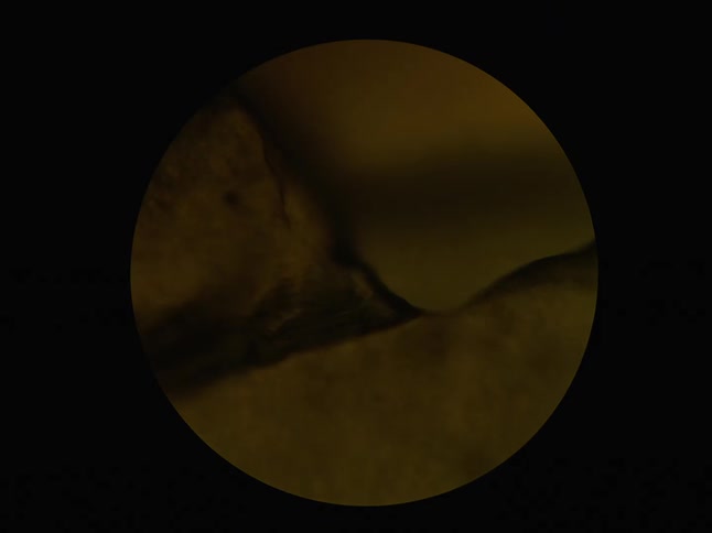 A detailed microscopic view of a yellow, textured substance with a torn edge, with the focus shifting throughout