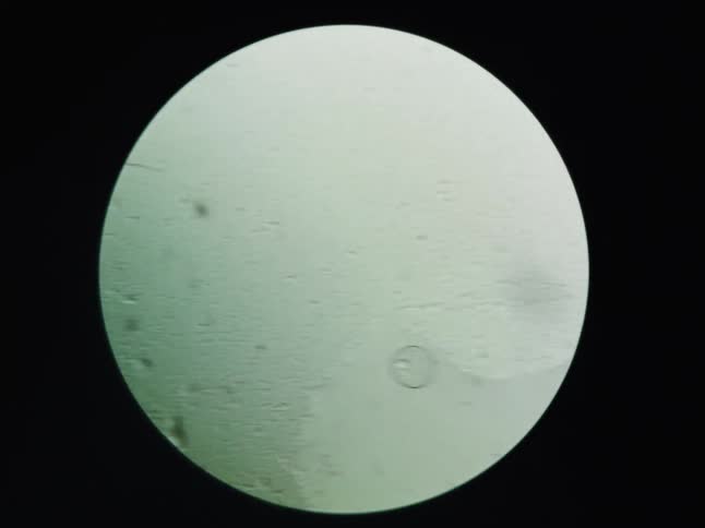 Scientific footage from a microscope lens shows the movement of tiny cells, bubbles, and particles in a liquid substance
