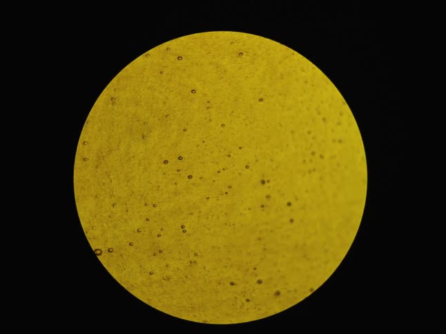 A microscopic view of a yellow substance with floating particles inside a circular frame that fades to black