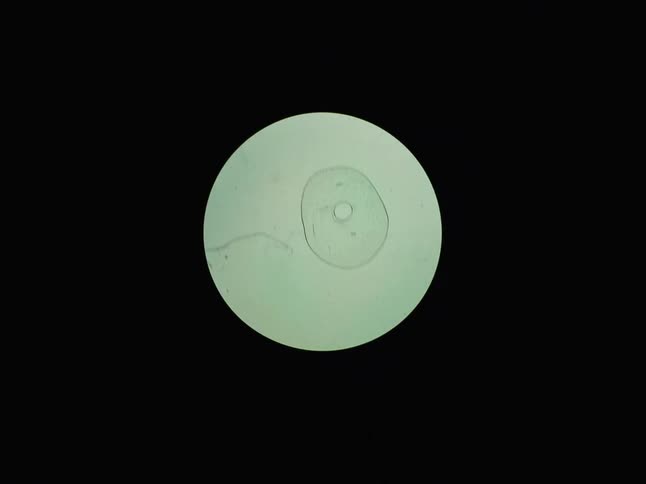 An amoeba, a single-celled organism, is observed moving and changing shape under a microscope