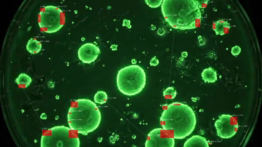 Time-lapse of glowing green bacterial colonies multiplying in a petri dish with a futuristic scientific data analysis overlay