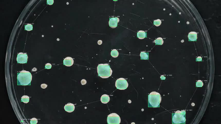 Digital analysis overlay tracks the time-lapse growth of bacteria colonies within a petri dish