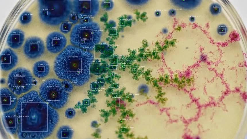 Artificial intelligence analyzes the growth of colorful bacteria and mold colonies in a petri dish time-lapse