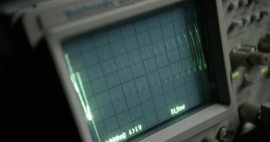 Lines flash on the screen of monitoring equipment