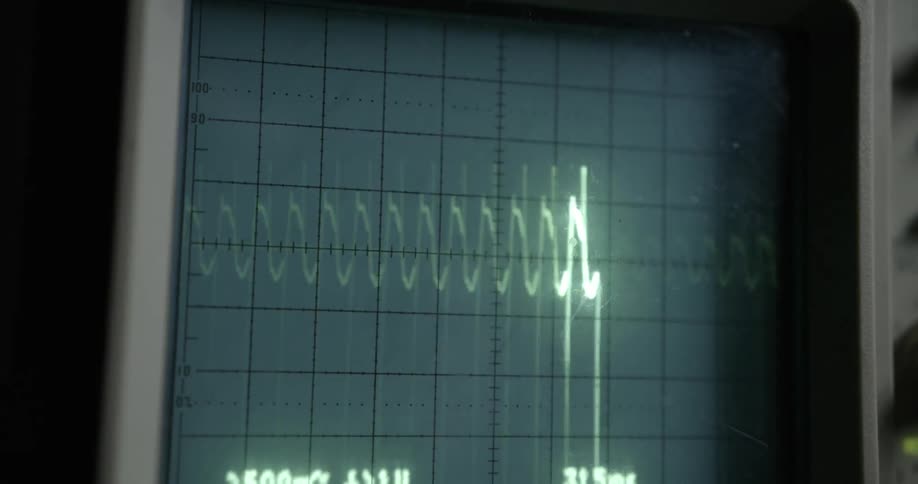 The medical monitor is flashing swirled lines