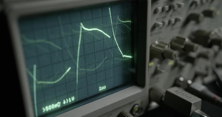 A piece of monitoring equipment displays moving lines on the screen