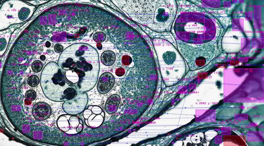 Scientific AI software scans and analyzes a close-up microscopic view of biological cells