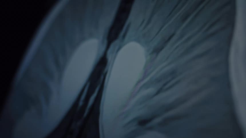 An animated, close-up MRI scan shows the detailed internal structure of a human knee joint