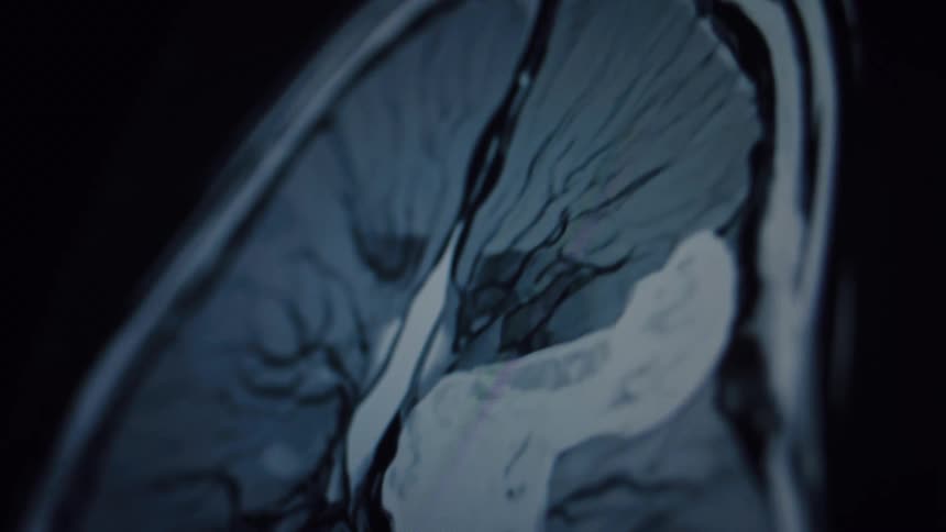 A static, close-up shot captures the rhythmic beating of a human heart on an MRI scan screen