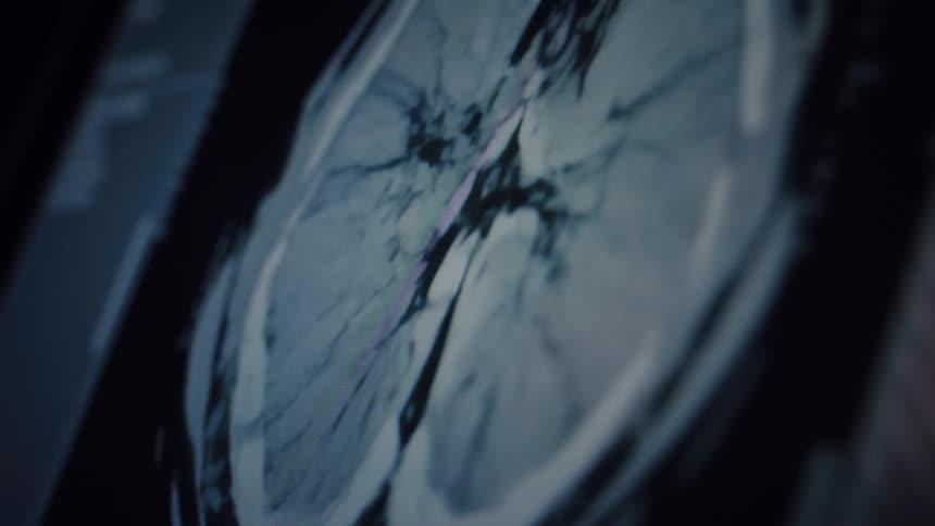 A cinematic close-up of a computer screen displaying a detailed, animated CT scan of human lungs for medical analysis