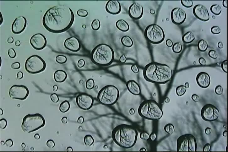 A close-up of raindrops on a window pane, each droplet reflecting the silhouette of a bare tree