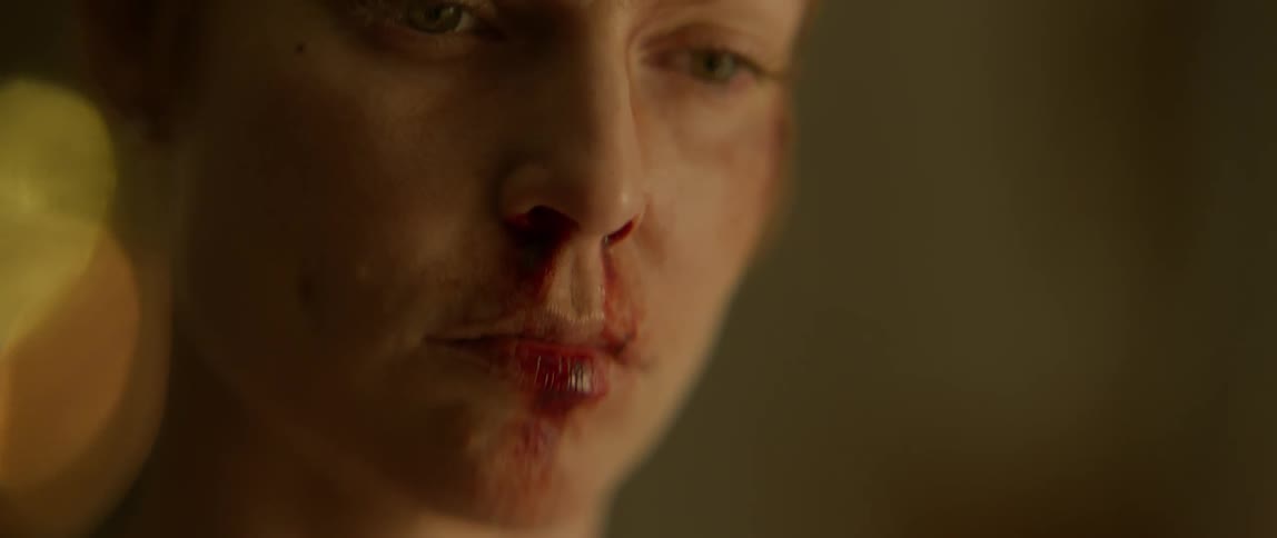 A woman's face is covered with bruises and blood