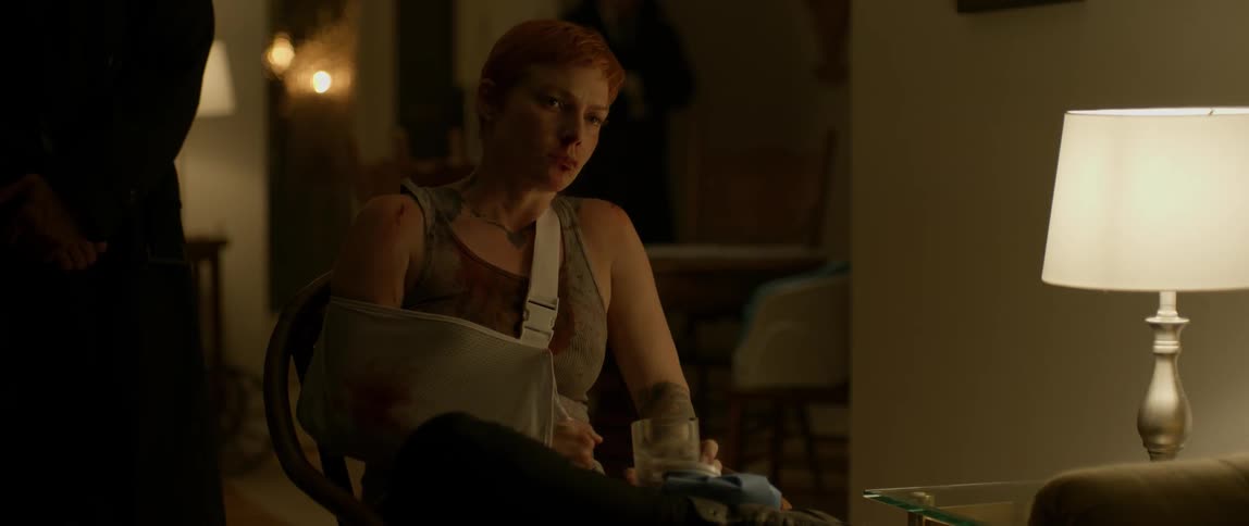 A woman with bruises and injuries sits in a chair drinking