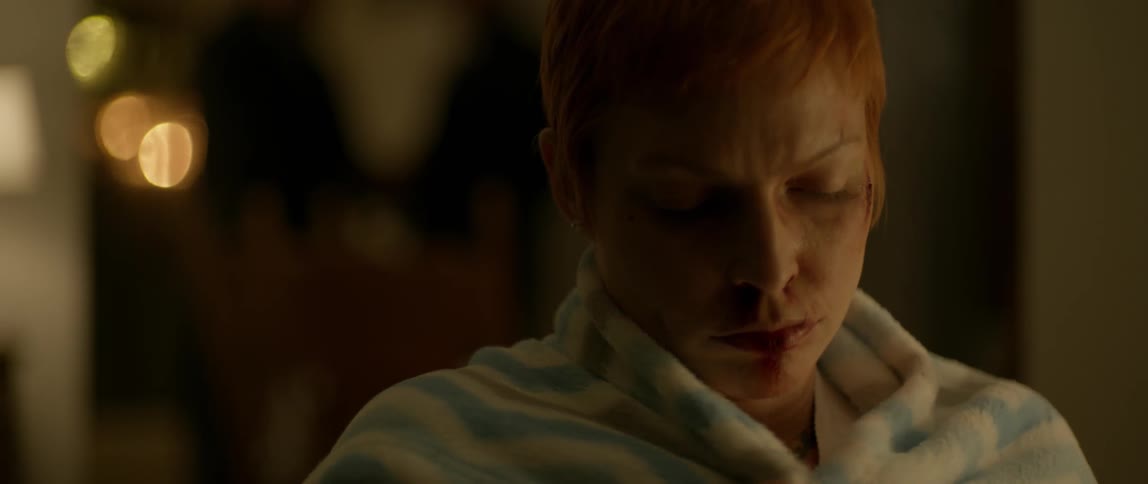 A woman with red hair and a bruised face hugs a blanket around her shoulders