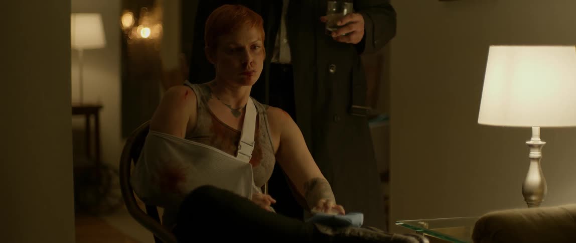 A woman with her arm in a sling is covered in blood