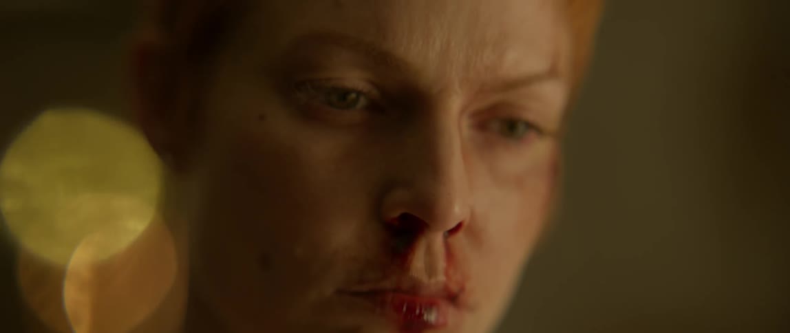 A woman's face is covered in bruises and blood