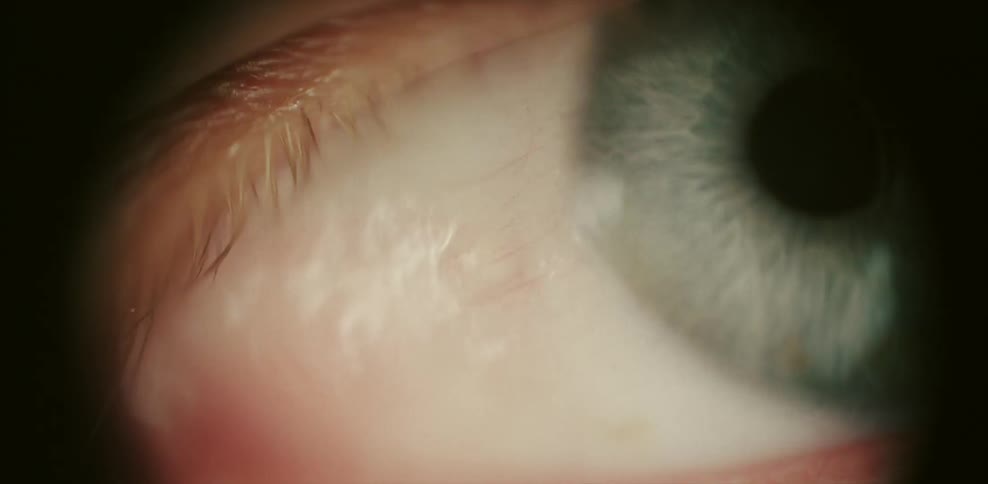 Close up of a person's blue eye