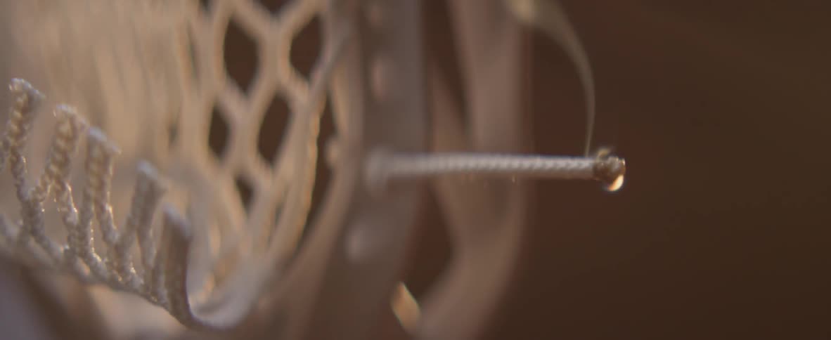 A flame is applied to the end of some twine on a racket