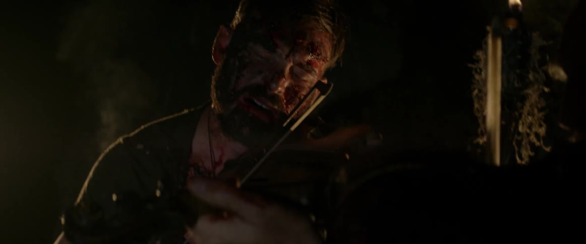 A man is injured in a cave