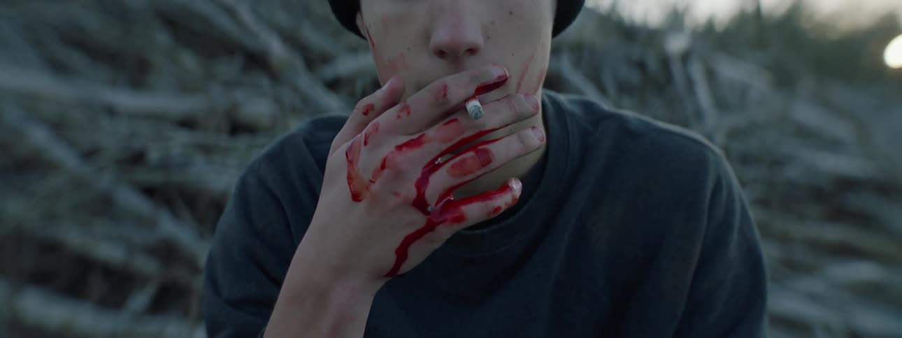 A teenager is smoking a cigarette with his hand covered in blood
