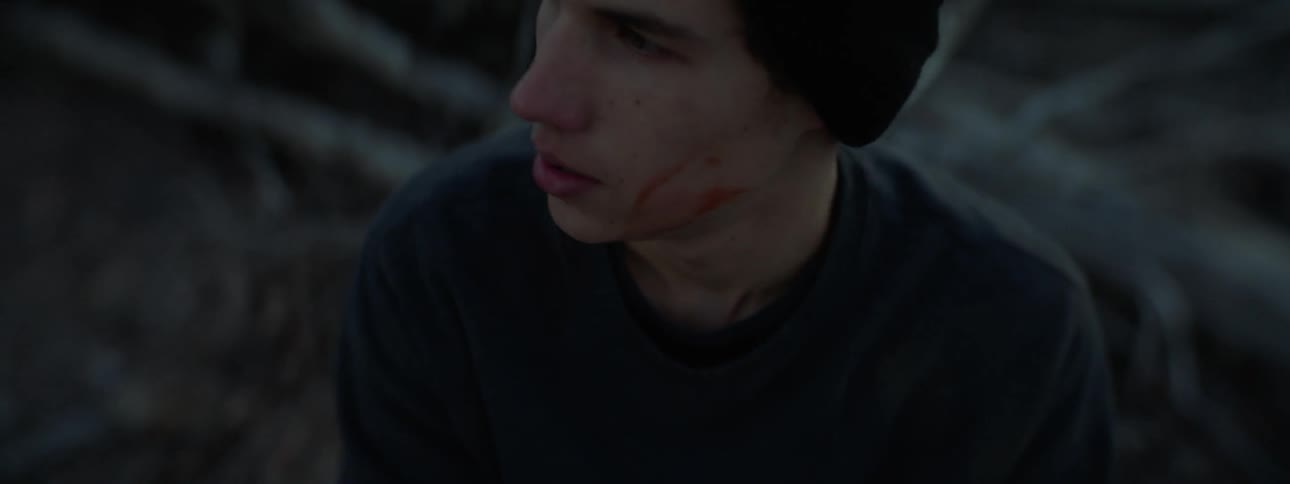 A man with blood on his hands is smoking