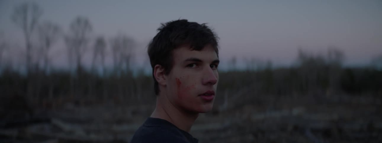 A young man with blood on his face is looking at the camera