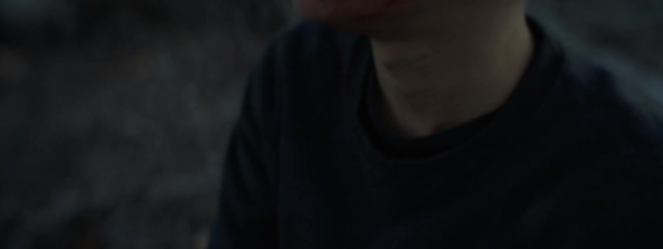 A teenage boy with blood on his hands is smoking