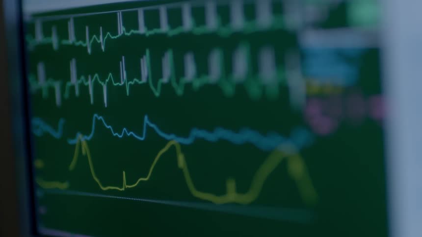 A display shows a moving chart of curving lines